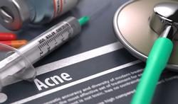 FDA stelt stricte regels voor acne-geneesmiddel