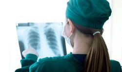 Pneumonie : signaux d’alerte et groupes à risque 