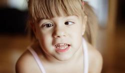 Scheelzien (strabismus) bij kinderen en volwassenen: oorzaak en behandeling