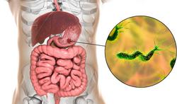 Helicobacter pylori: maagbacterie als oorzaak van overgewicht