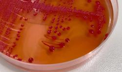 Hoe gevaarlijk is de STEC-bacterie?