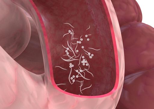 Oxyures : Quel traitement contre ces vers intestinaux très ...