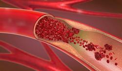 Wat is een coronarografie (coronaire angiografie)?