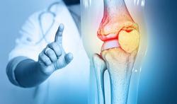 Wat is artrose of osteoartritis?