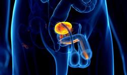Infection urinaire chez l’homme: causes, symptômes et traitements