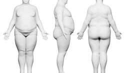 Wat is een buried penis (verborgen penis)?