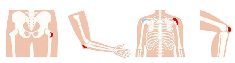 Getty_bursitis_2025.jpg