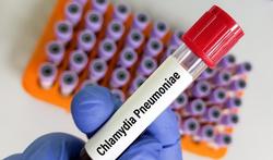 Chlamydia pneumoniae: oorzaak van luchtweginfecties en chronische ziekten