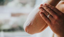 Droge huid: oorzaken en wat doen?