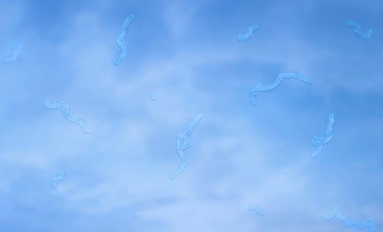 © Getty Images - Myodésopsies, corps flottants comme des mouches qui volent devant les yeux Getty_glasvocht_floaters_myodesopsies_2025.jpg