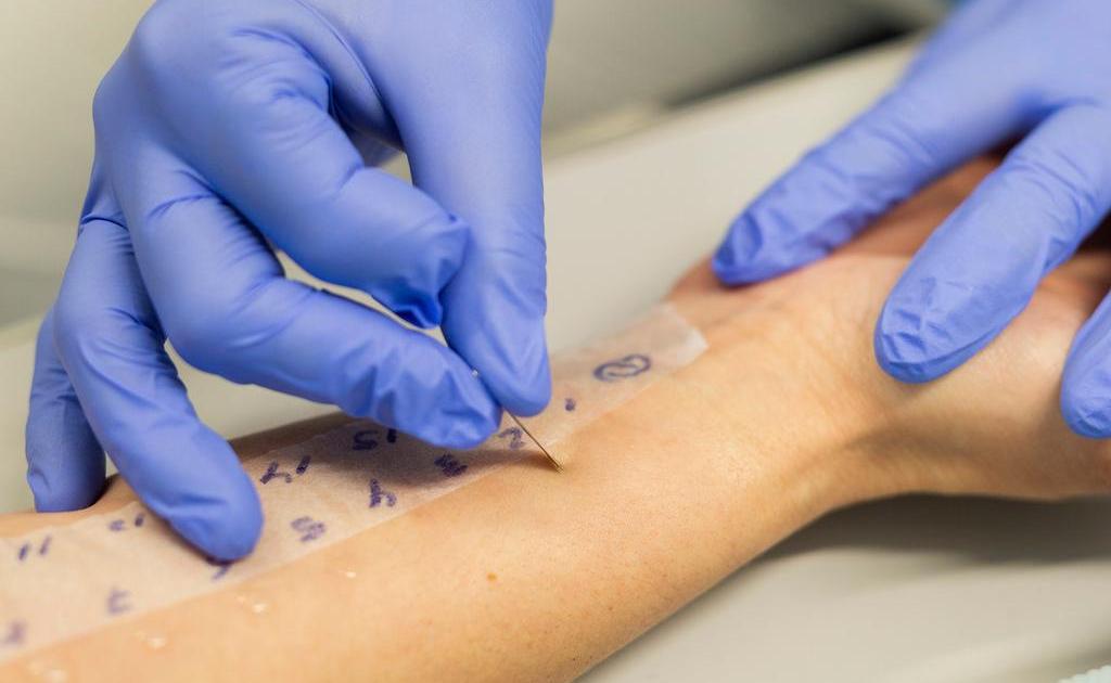 Getty_huidpriktest_allergie_2026.jpg