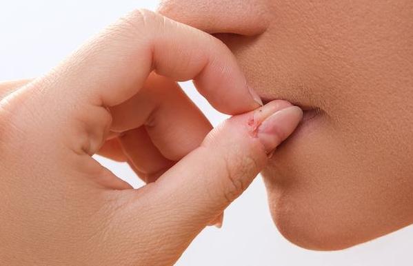© Getty Images / skin picking disorder (dermatillomanie): dwangmatig pulken aan huid Getty_huidpulken_nagel_2025.jpg