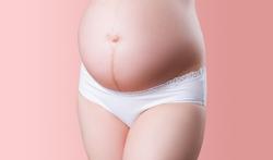 Alles over een zwangerschapsstreep of linea nigra