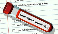 Lipoproteïne(a) of Lp(a): de bloedtest die je één keer moet laten doen