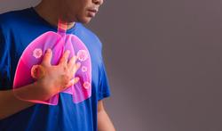 Longvlieskanker (asbestkanker): oorzaken, symptomen en wat je kan doen