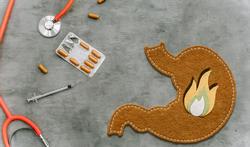 Quels sont les traitements du reflux chez l'adulte ?