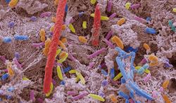 Microbiote buccal : comment impacte-t-il notre santé ?