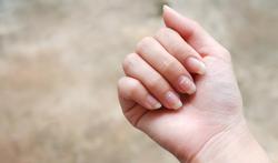 Dit zijn de 9 meest voorkomende nagelproblemen