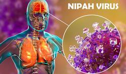 Moeten we ons zorgen maken over het dodelijke Nipah-virus?