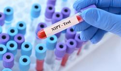 Alles wat je moet weten over de NIP-test (NIPT)