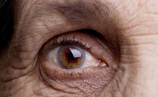 Getty_oog_arcus_senilis_2025.jpg