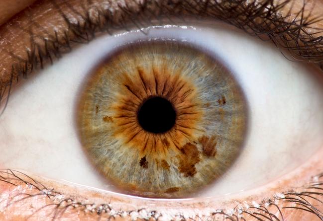 Getty_oog_oeil_grain_de_beaute_2025.jpg
