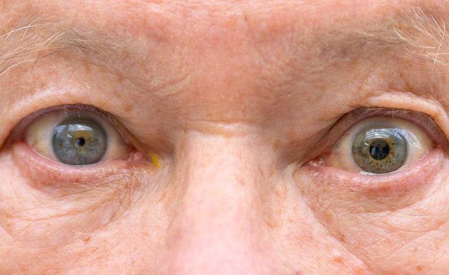 Getty_oog_oeil_pupille_2025.jpg