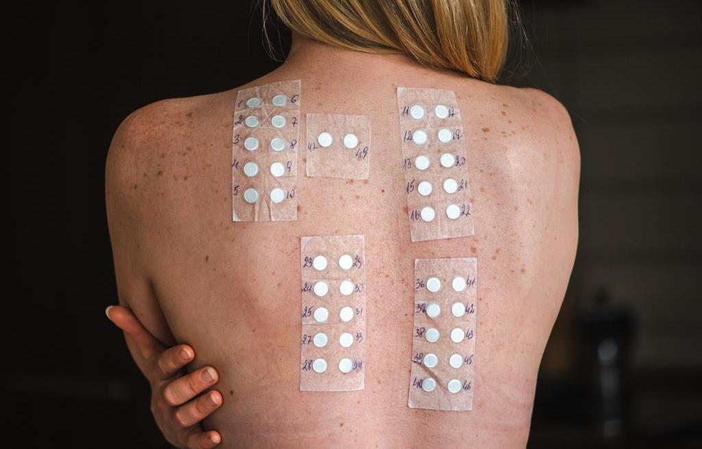 Getty_patchtest_allergie_2026.jpg