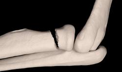 Radiuskopfractuur: pijn aan buitenkant elleboog