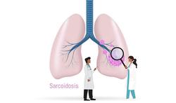 Sarcoïdose: symptomen, oorzaak en behandeling