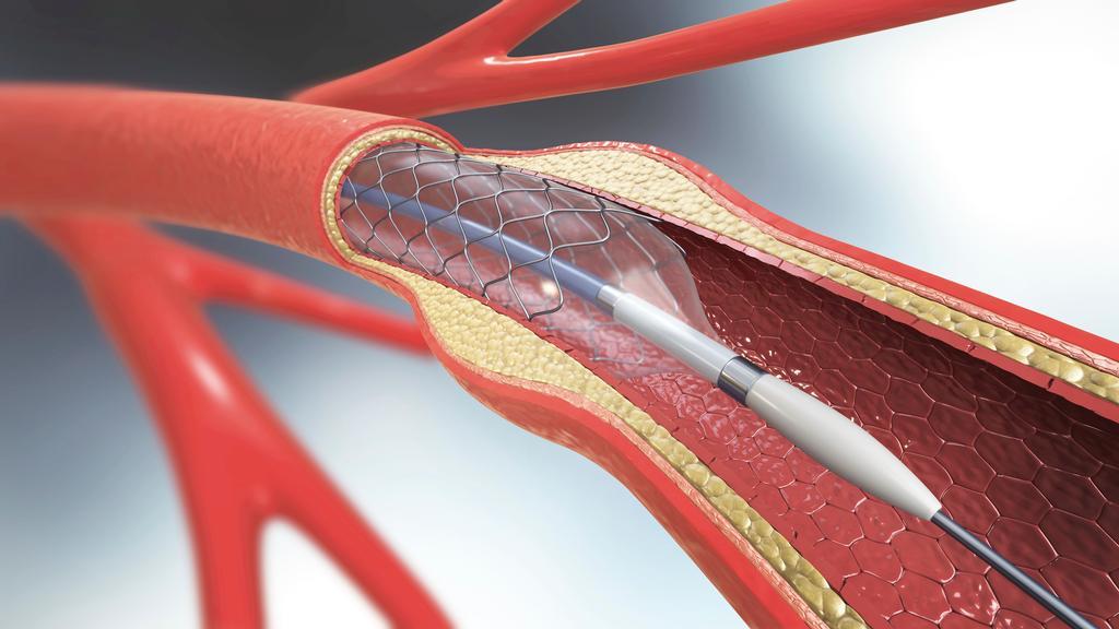 Getty_stent_aders_2024.jpg