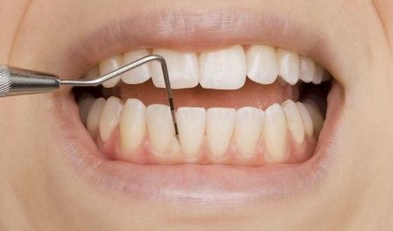 Parodontitis: belangrijke oorzaak van tandverlies gezondheid.be