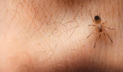 Morsures d'araignées : risques, symptômes, traitement