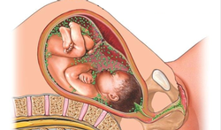 Groep B Streptokokken (GBS) : gevaarlijk tijdens de zwangerschap