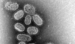 Vidéo - Le virus de la grippe