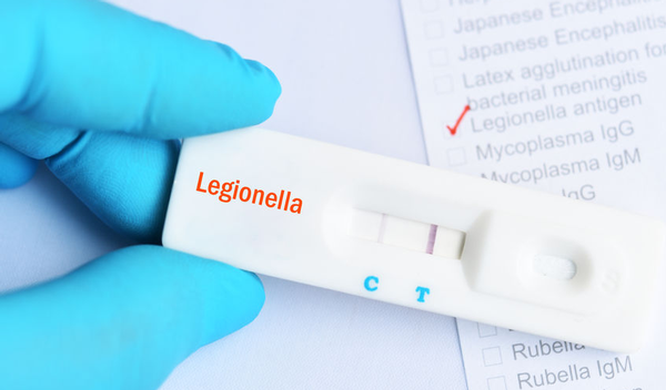 123-diagn-legionella-labo-06-19.png