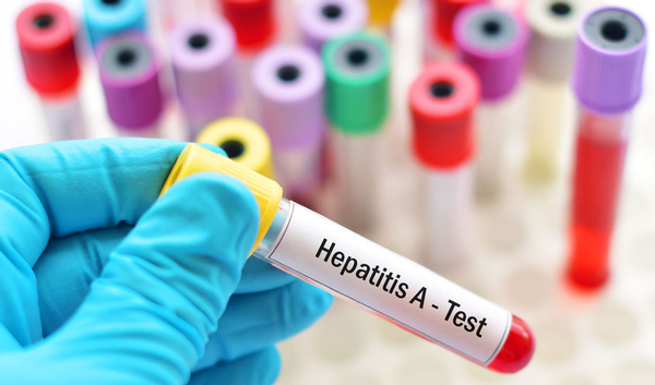 123-labo-hepatitisA-test-04-19.png