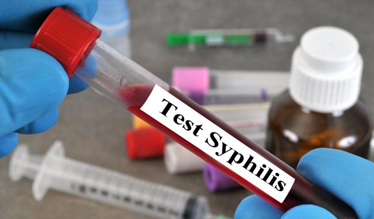123-m-syfilis-test-soa-15-9-21.jpg