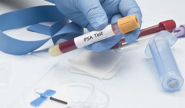 123-psa-test-labo-bloed-prostaat-02-19.jpg