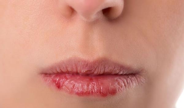 123h-lip-gesprongen-01-19.jpg