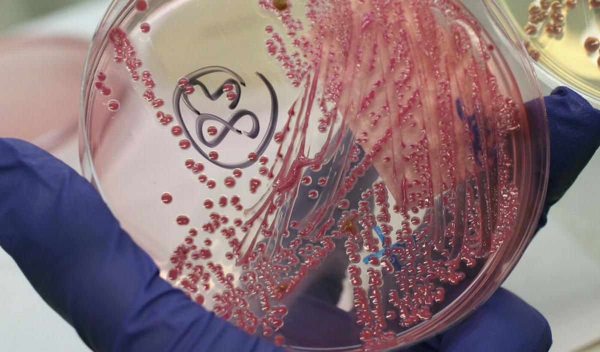 Getty_HUS_stec_ehec_ecoli_2025.jpg
