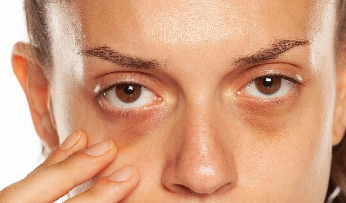 Getty_cernes_yeux_kringen_ogen_2026.jpg