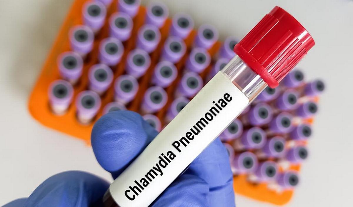 Getty_chlamydiapneumoniae_bloed_2024.jpg