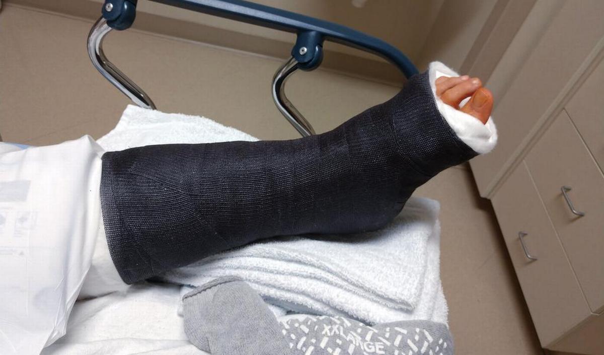 Getty_gips_gebrokenbeen_2026.jpg