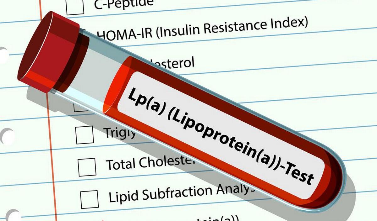 Getty_lipoprotein_bloedtest_2026.jpg