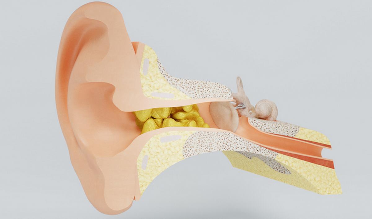 Getty_oorprop_bouchon_cerumen_2026.jpg