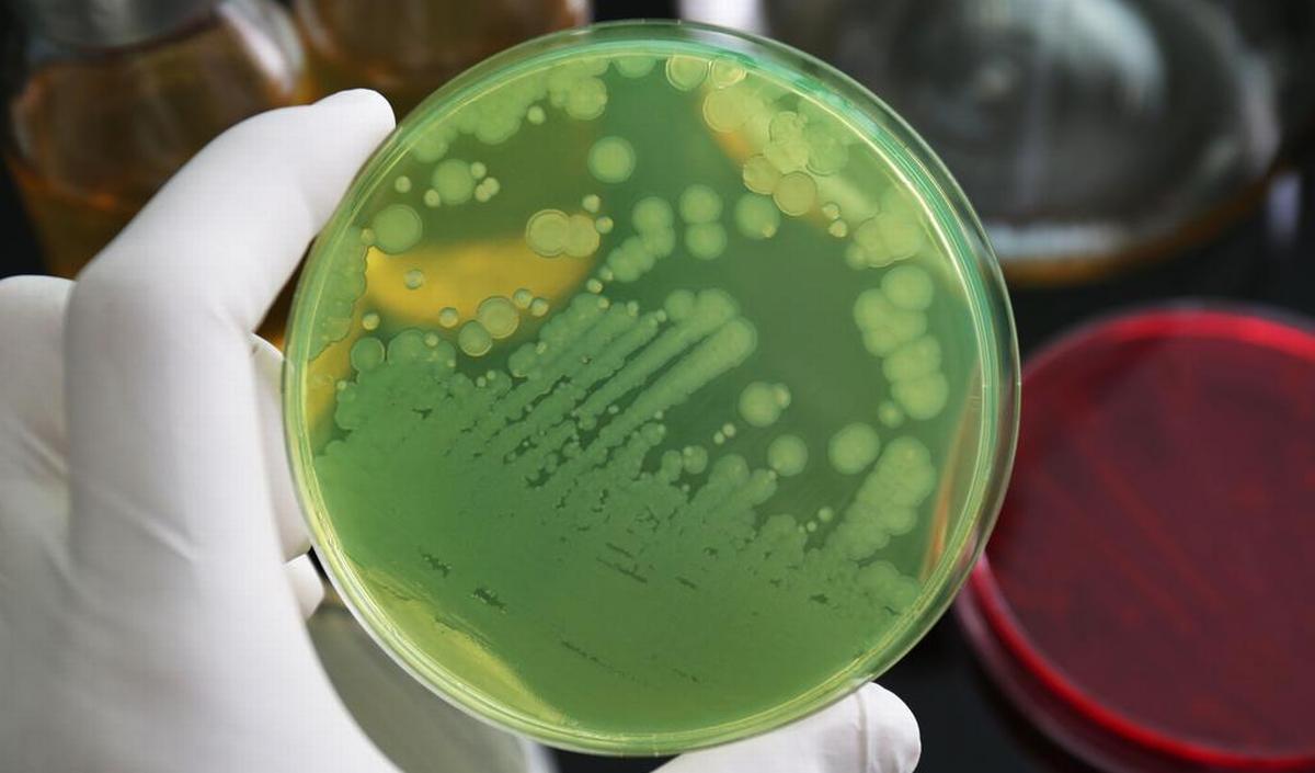 Getty_pseudomonas_2025.jpg